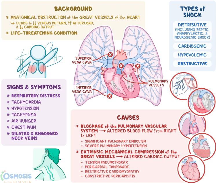 types of shock